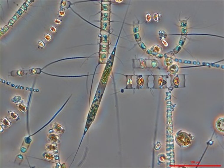 A microscope reveals marine diatom cells, which are an important group of phytoplankton in the oceans.